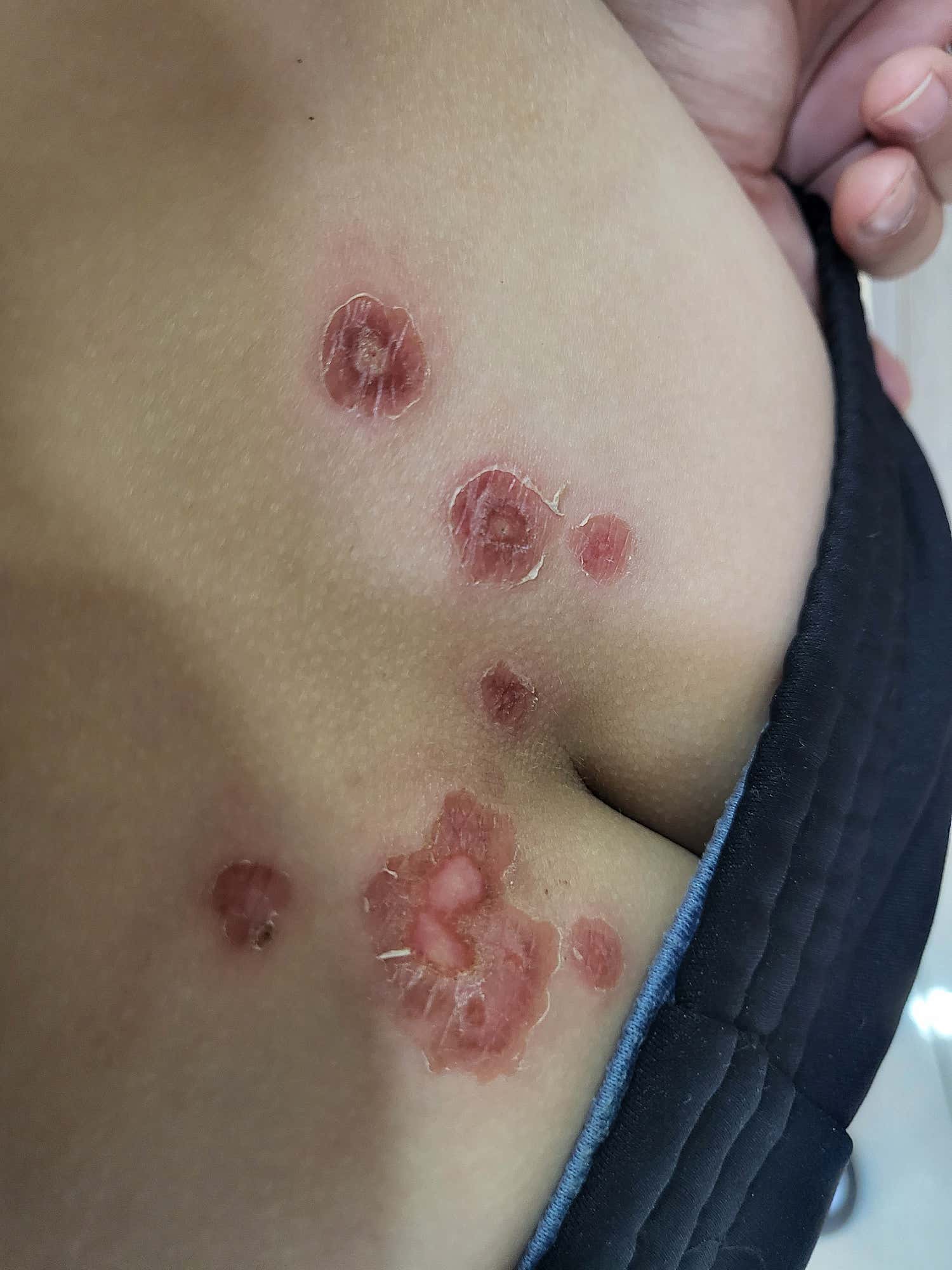 안양피부과의원