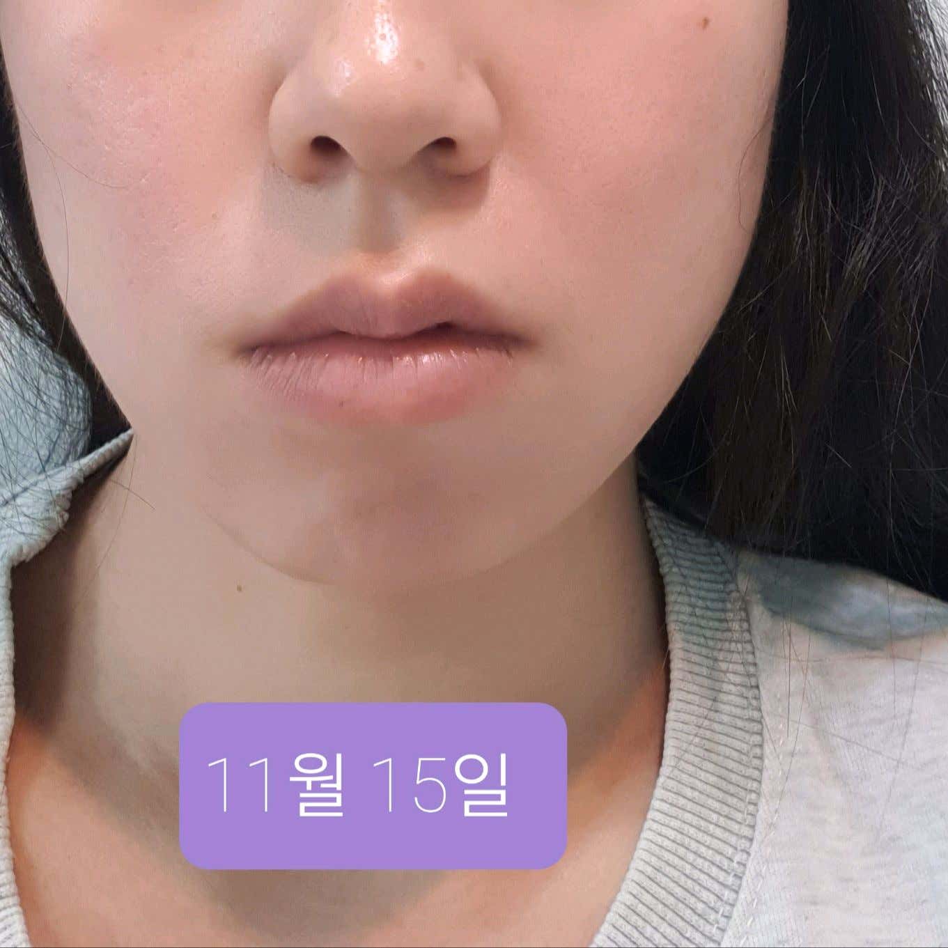아산수의원