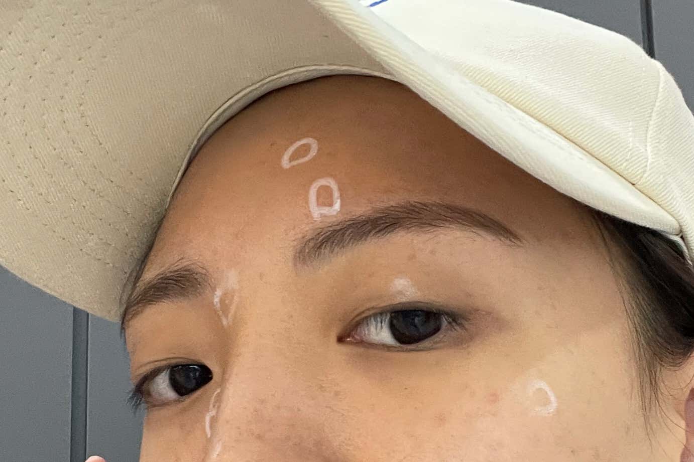 메이린의원 일산