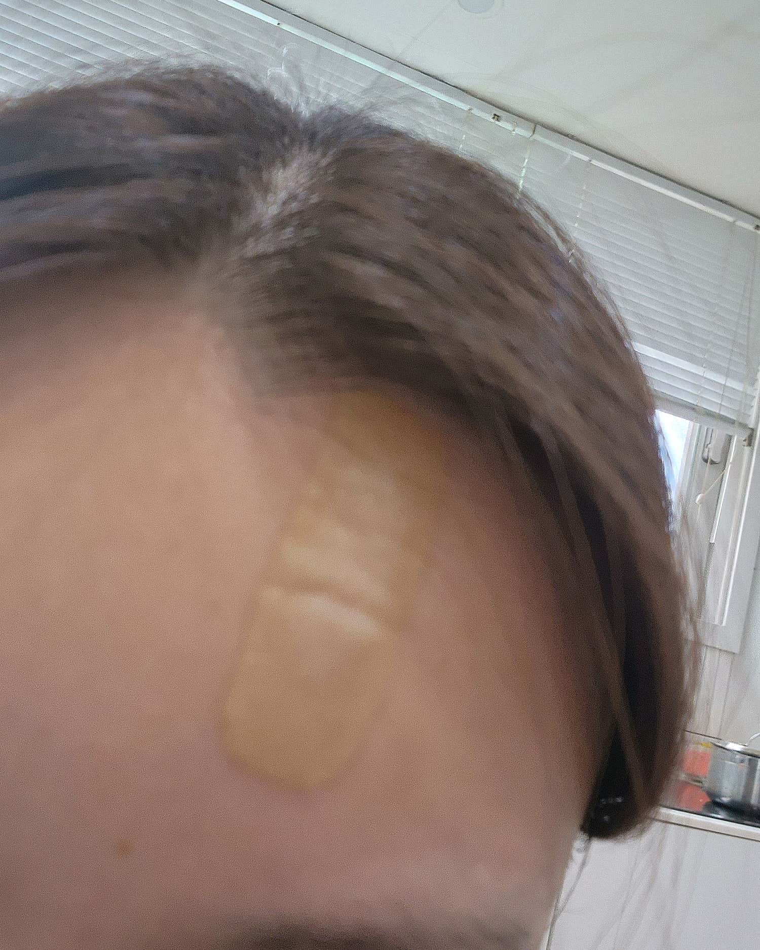 휴먼피부과의원 서울대점