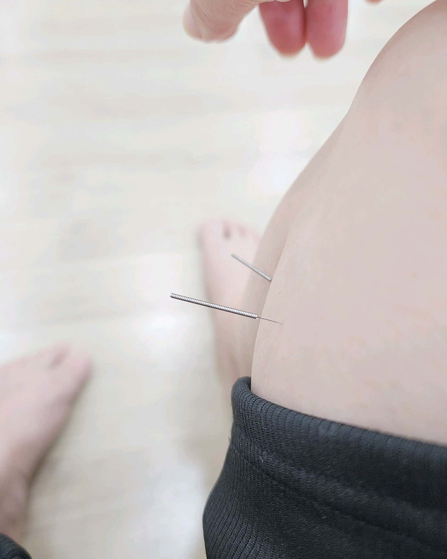 장승배기한의원