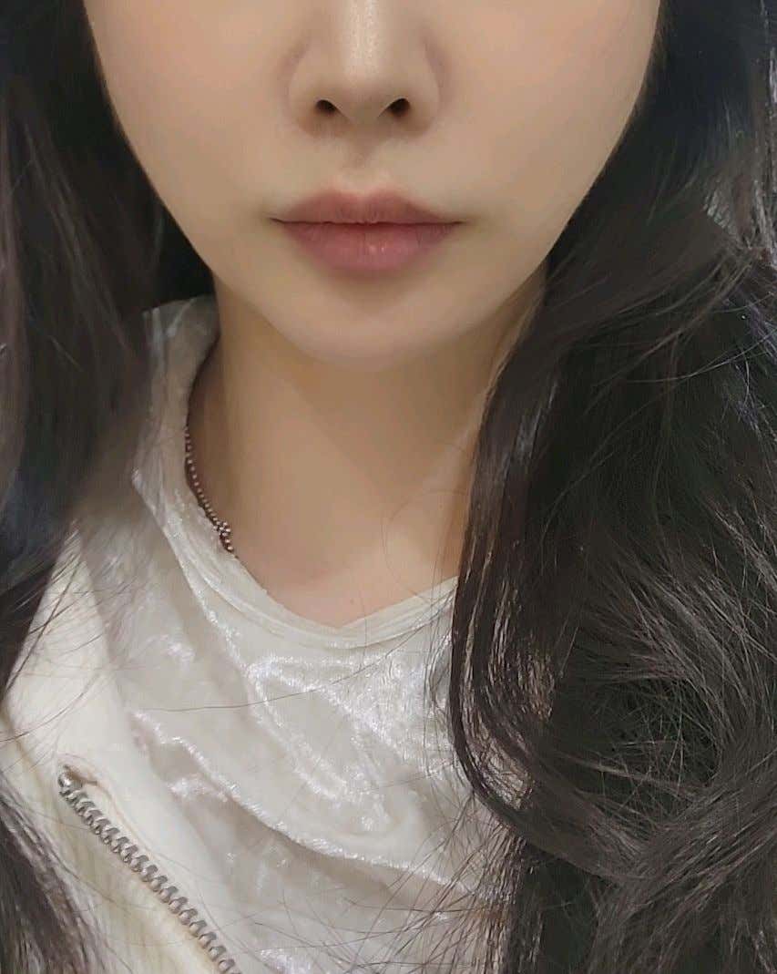 메이린의원 잠실롯데호텔