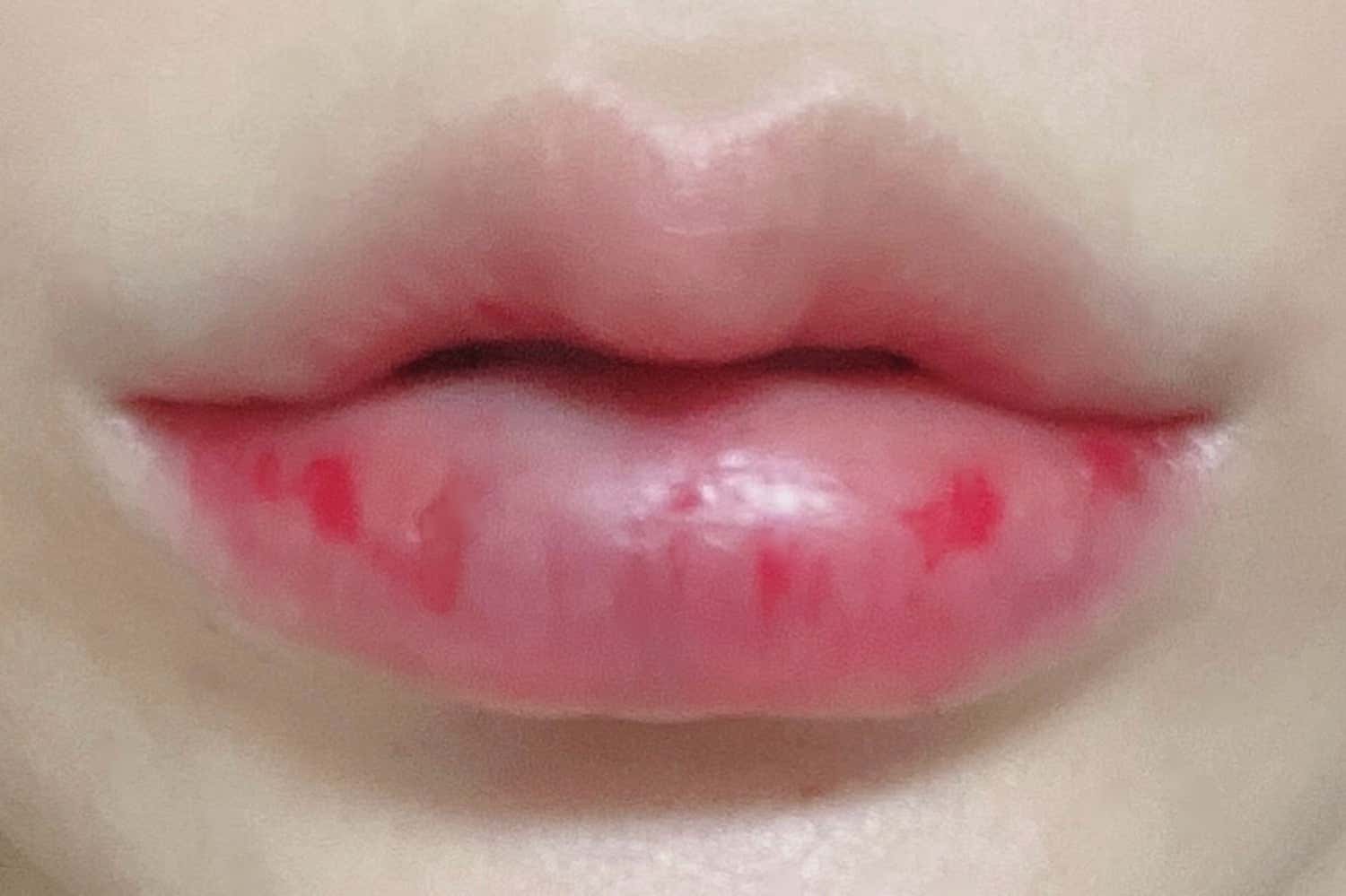 예쁜나의원
