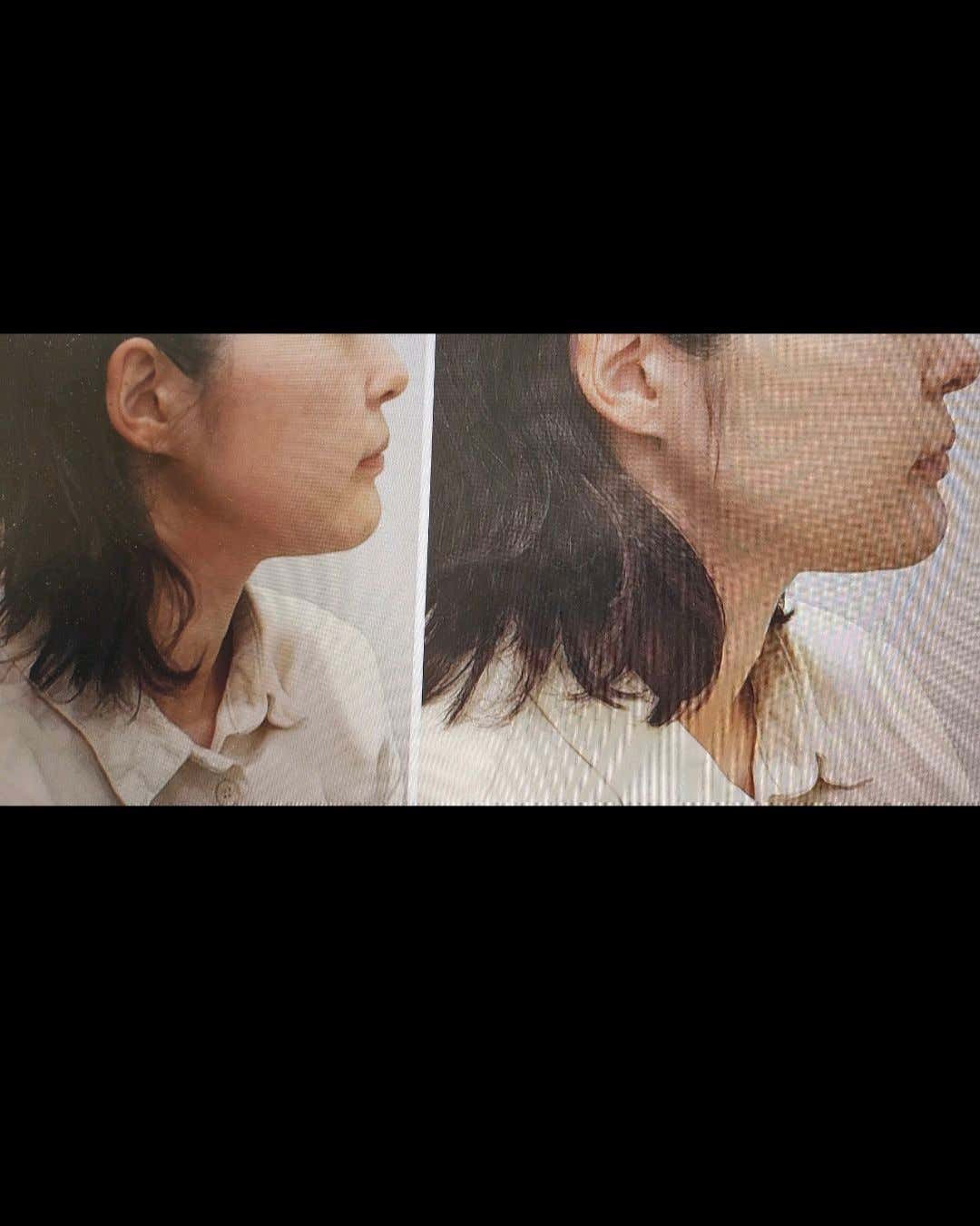 인제상쾌한이비인후과의원 피부 쁘띠 클리닉