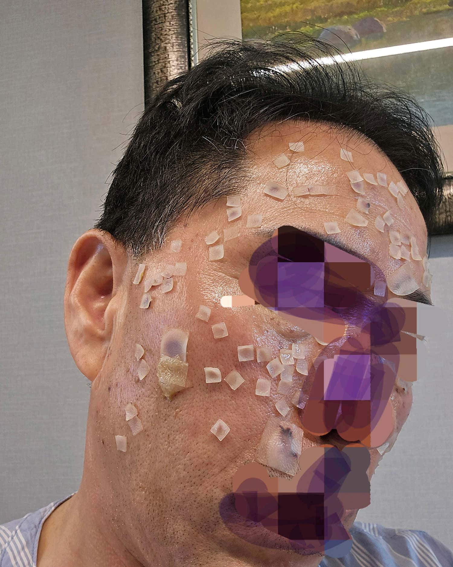 리멤버피부과의원 동탄점