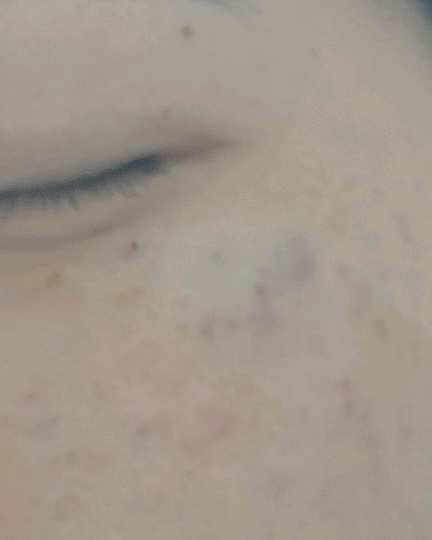 스타S피부과의원