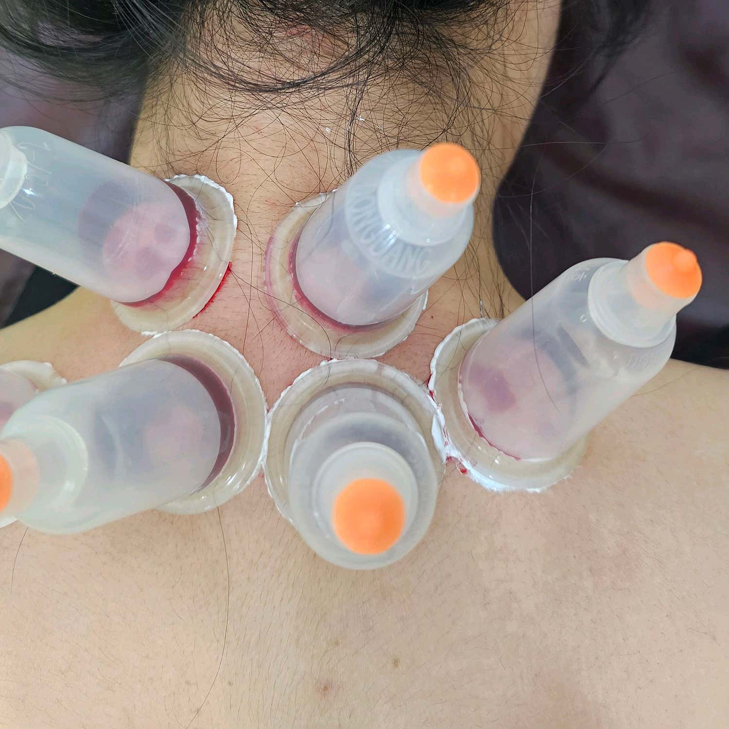 거북이한의원