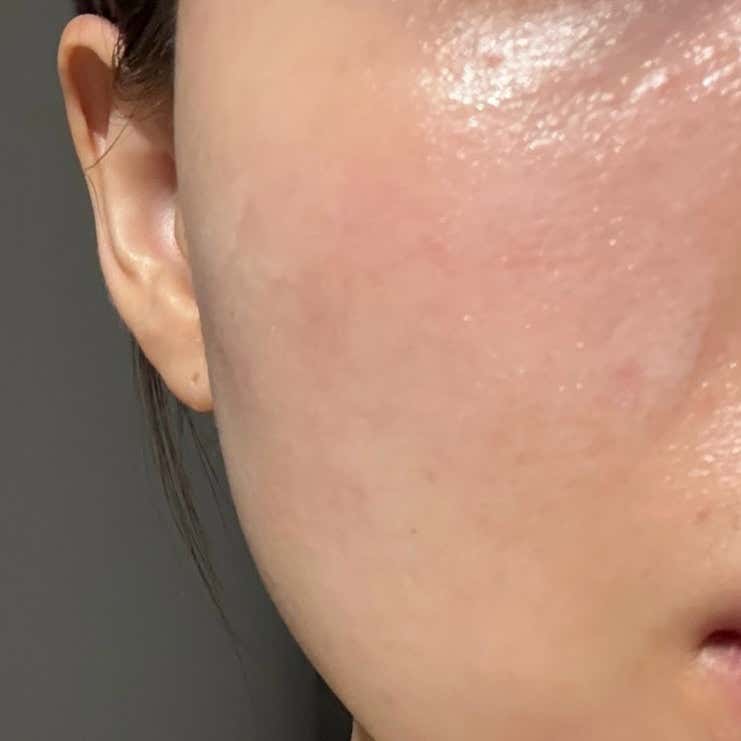 케이피부과의원 부산수영