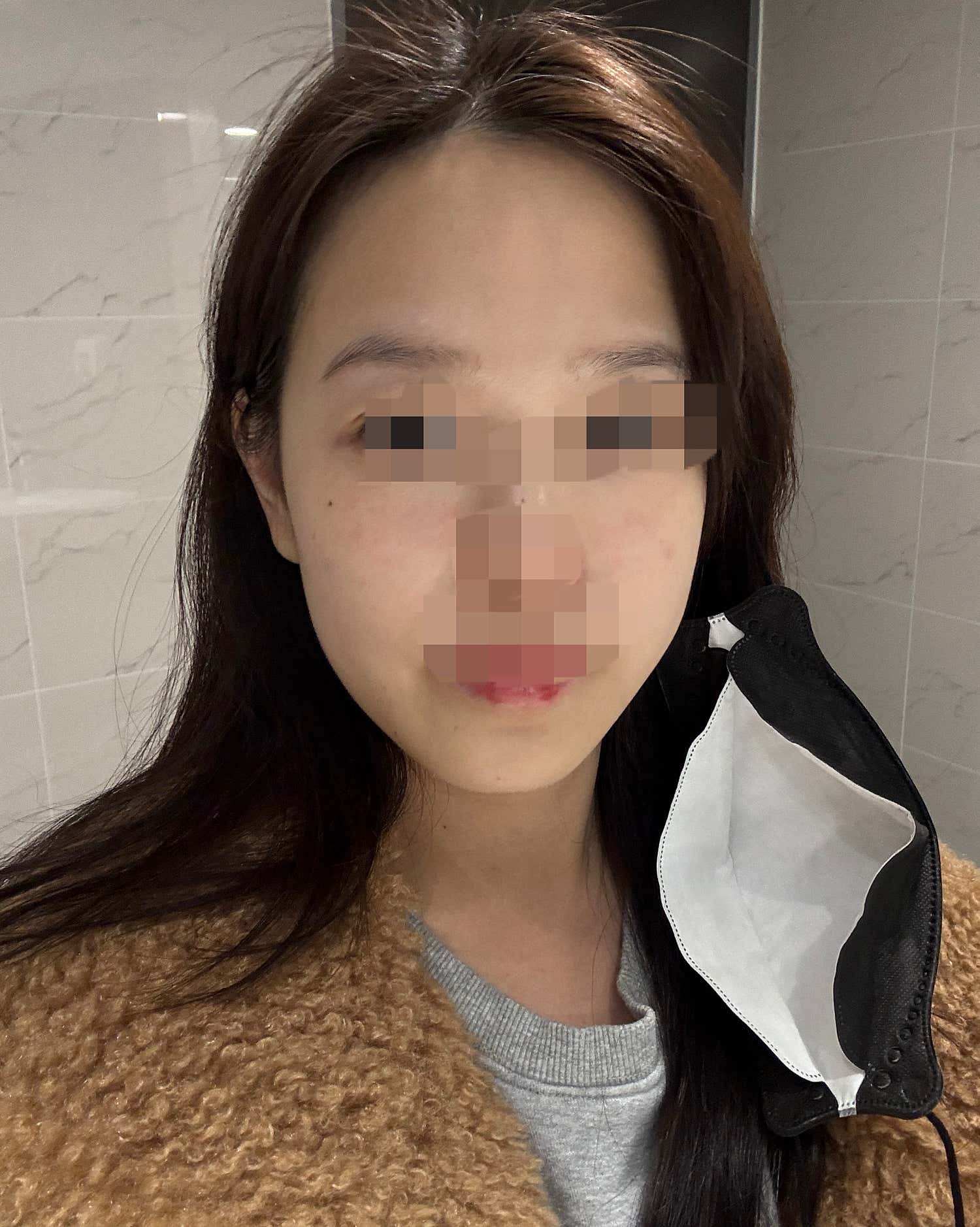 디에스타의원 수원광교