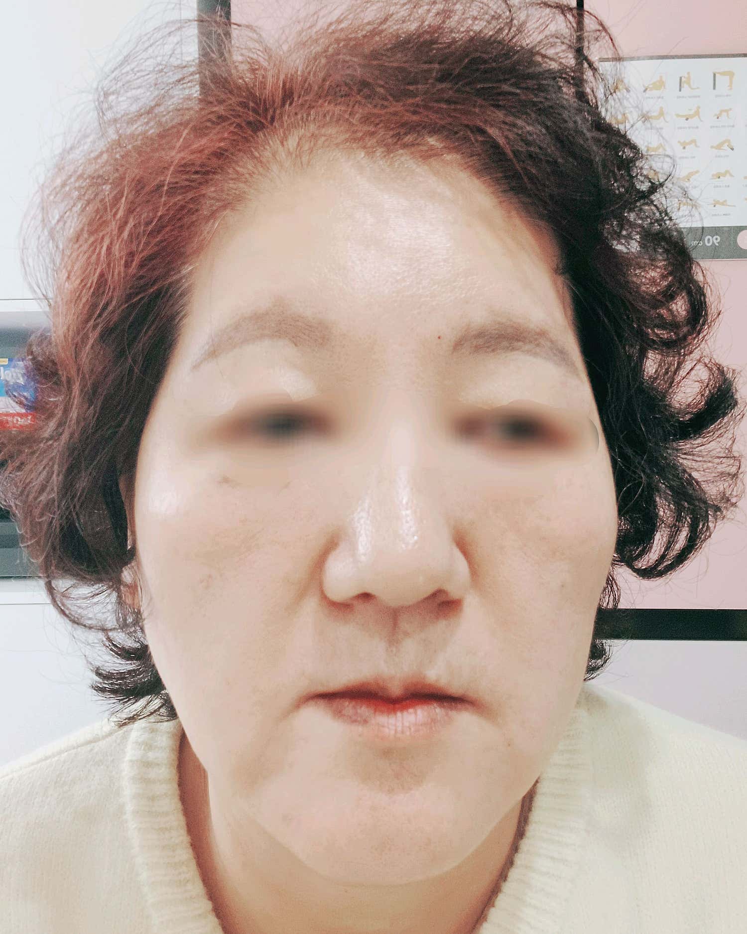 인천검단 리멤버피부과의원