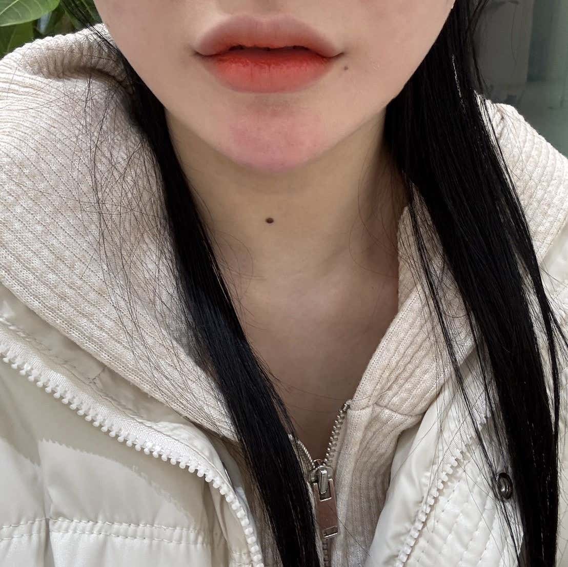 예사랑피부과의원 이미지
