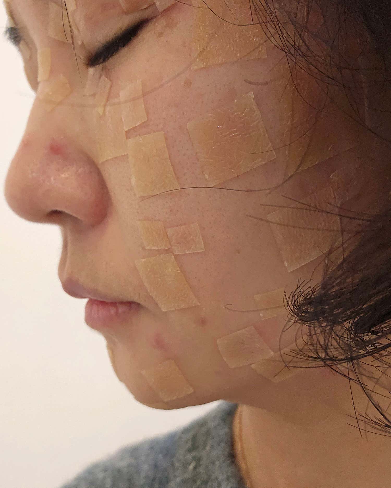 메이퓨어의원 중계은행사거리점