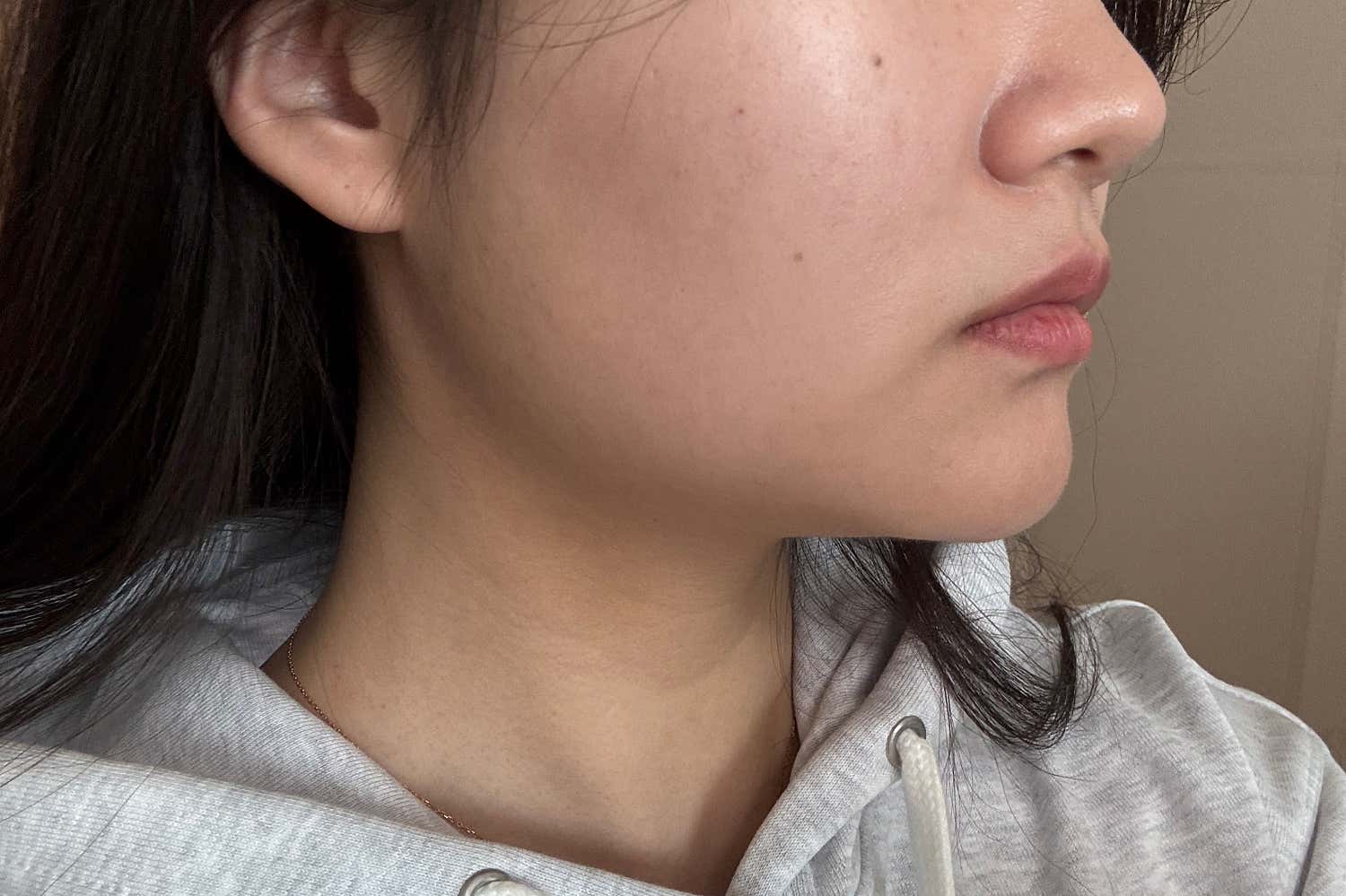 힐하우스피부과의원 수원본점