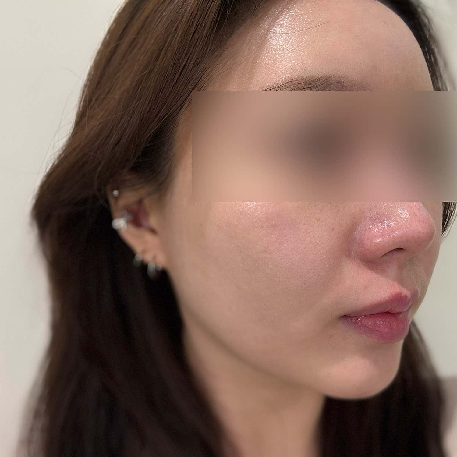 힐하우스피부과의원 건대점