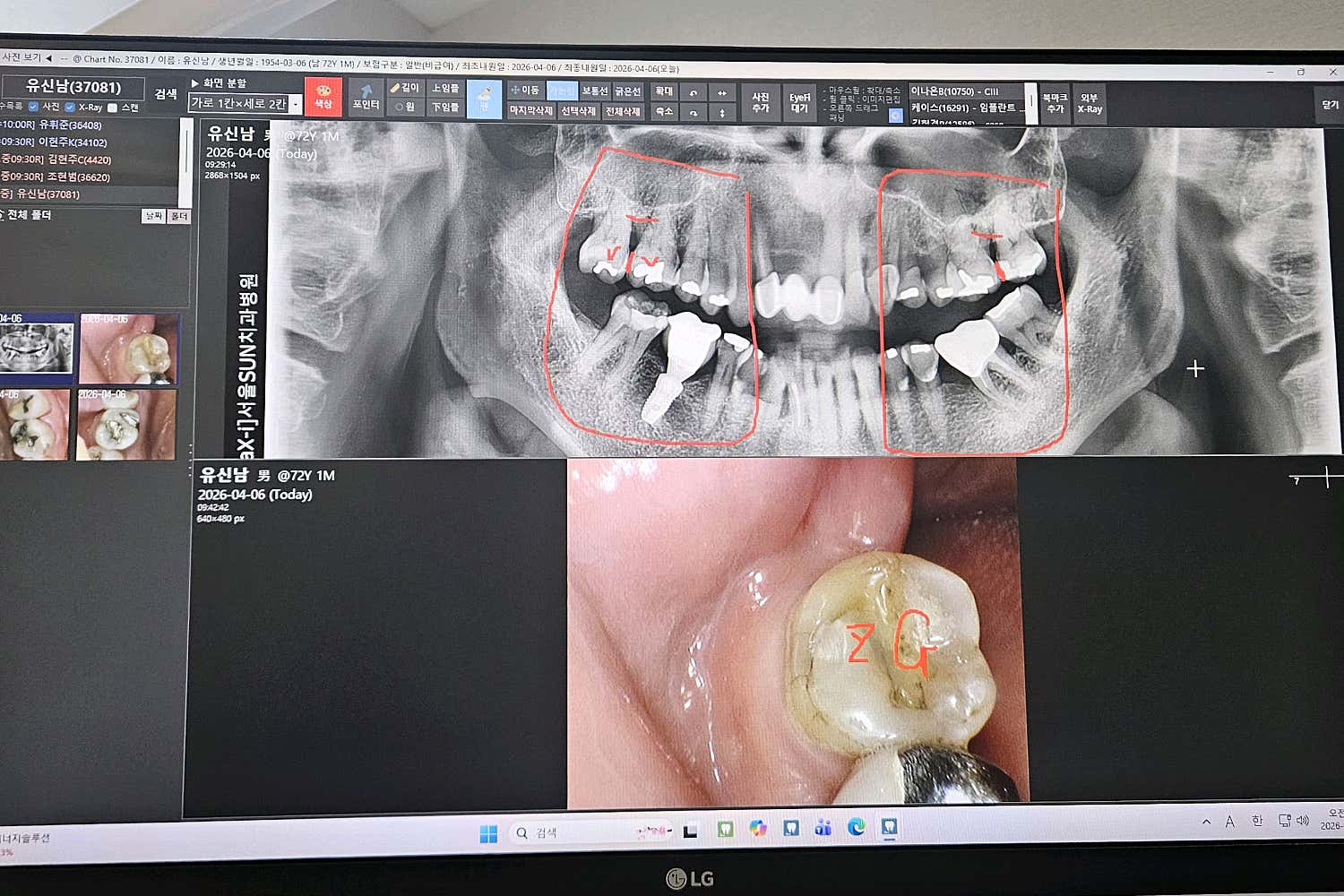 Review photo