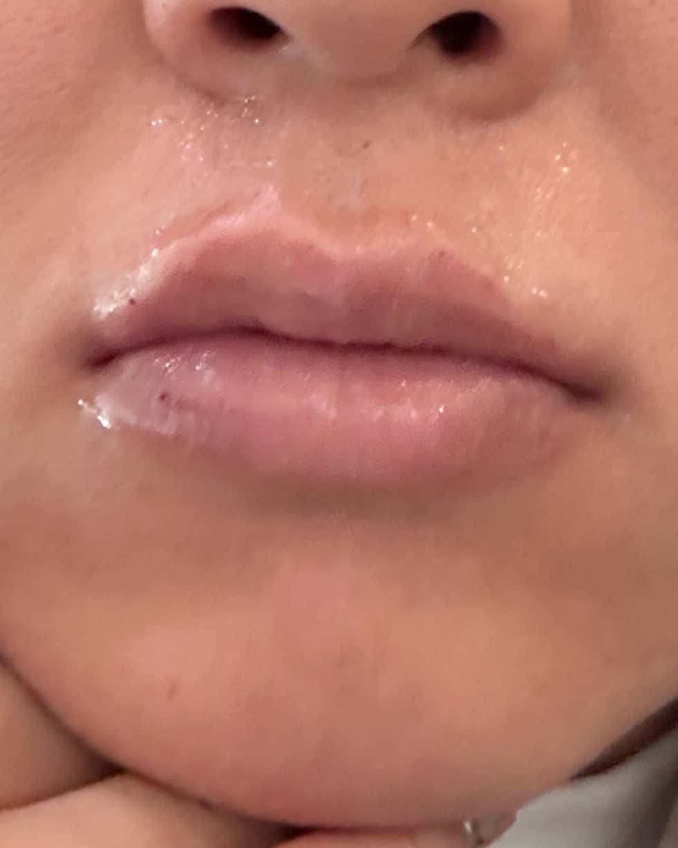 Review photo