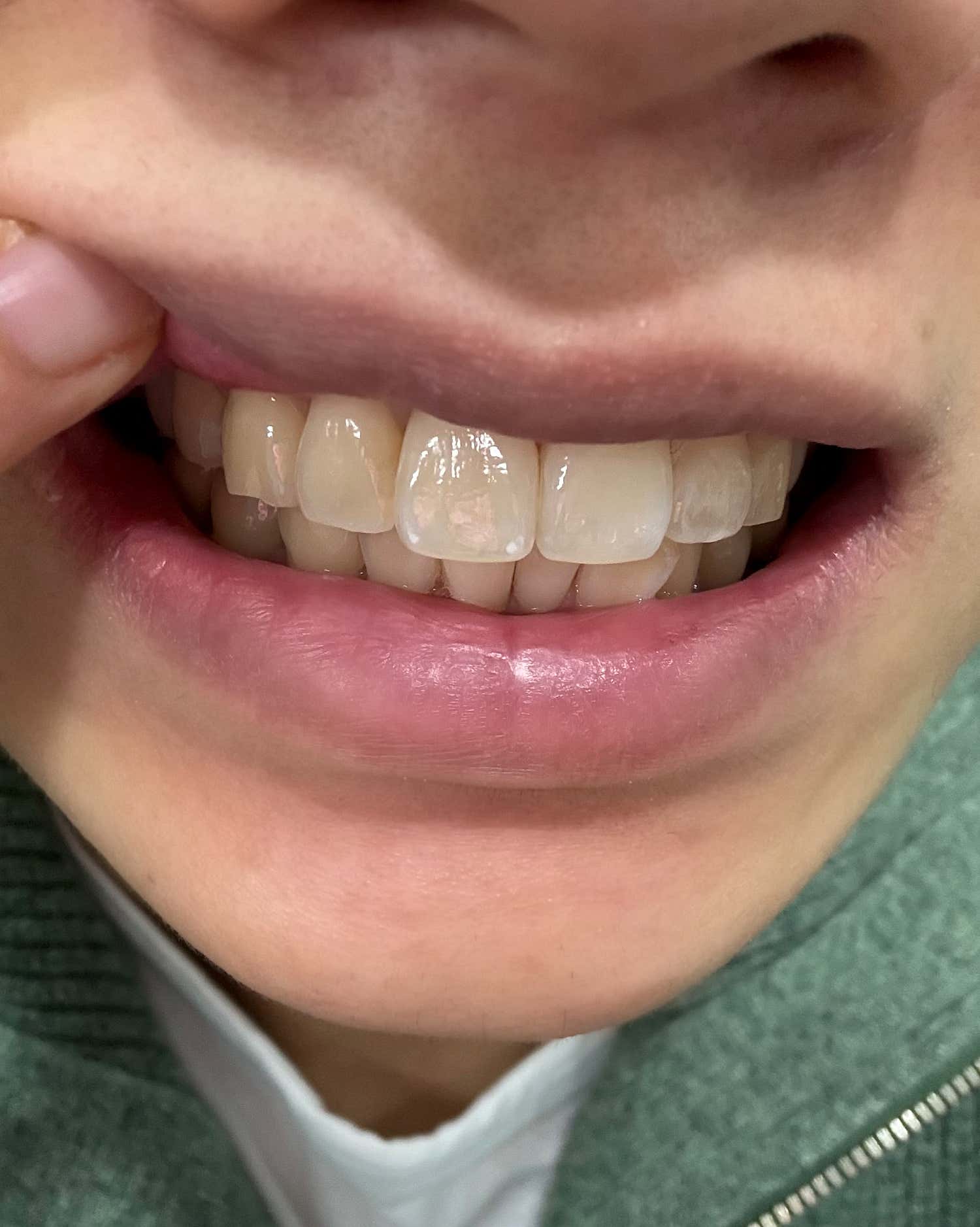 Review photo