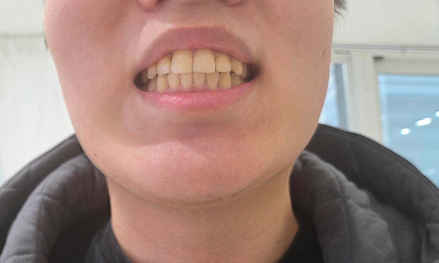 Review photo